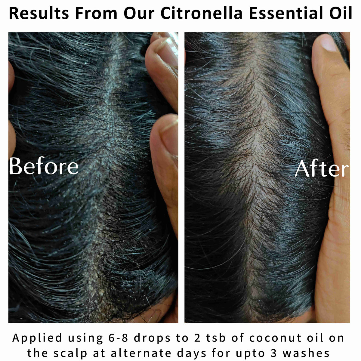 Before and after scalp images showing reduced visible flakes after using Java citronella essential oil